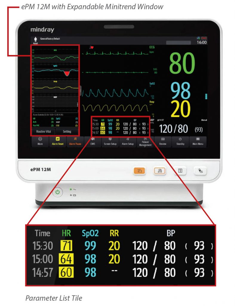 Mindray Medical Equipment - CE-Tech Sales for the Southeast